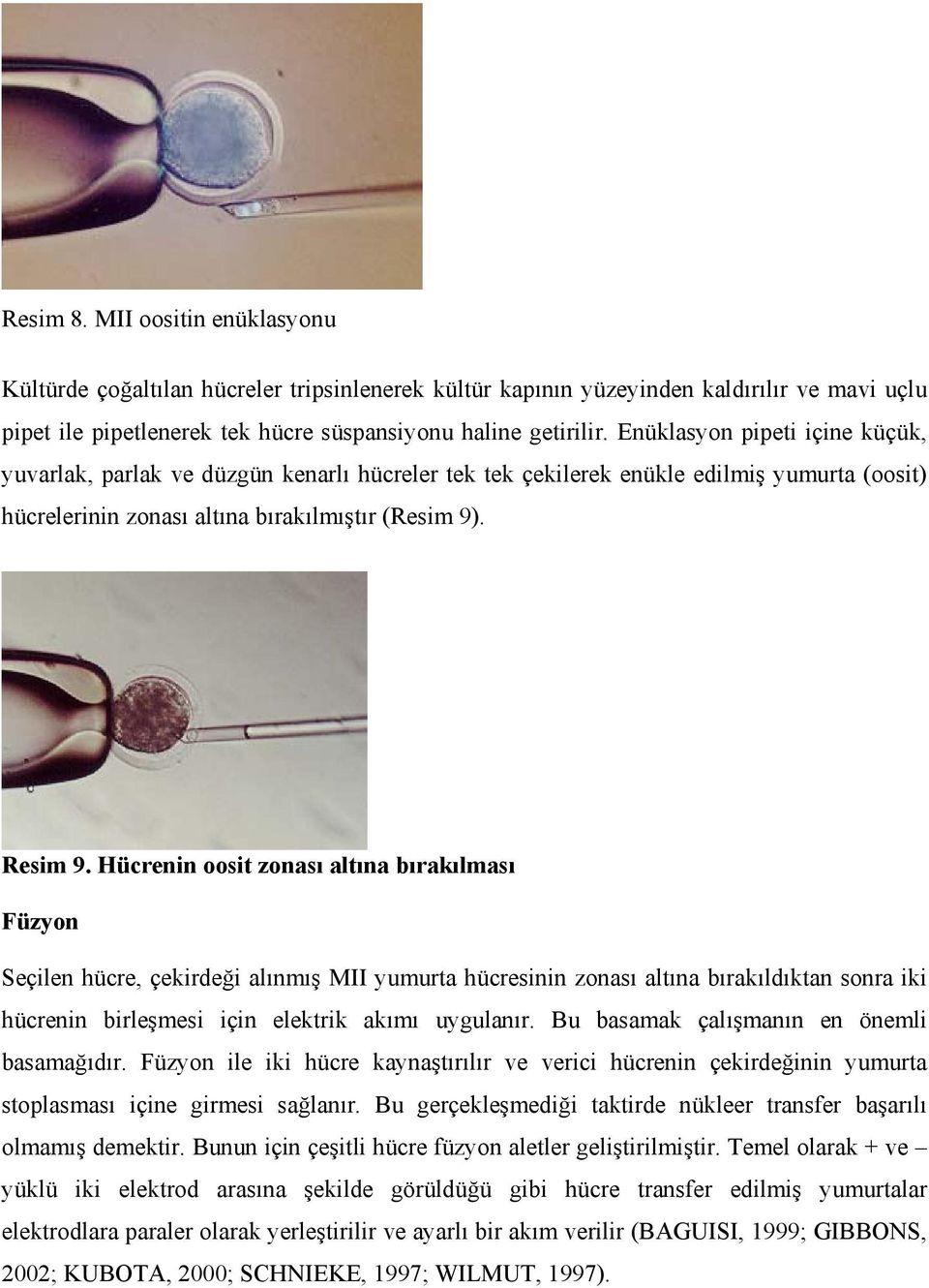 Hücrenin oosit zonası altına bırakılması Füzyon Seçilen hücre, çekirdeği alınmış MII yumurta hücresinin zonası altına bırakıldıktan sonra iki hücrenin birleşmesi için elektrik akımı uygulanır.