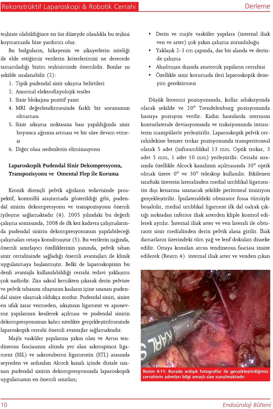 Tipik pudendal sinir sıkışma belirtileri 2. Anormal elektrofizyolojik testler 3. Sinir blokajına pozitif yanıt 4. MRI değerlendirmesinde farklı bir sorununun olmaması 5.