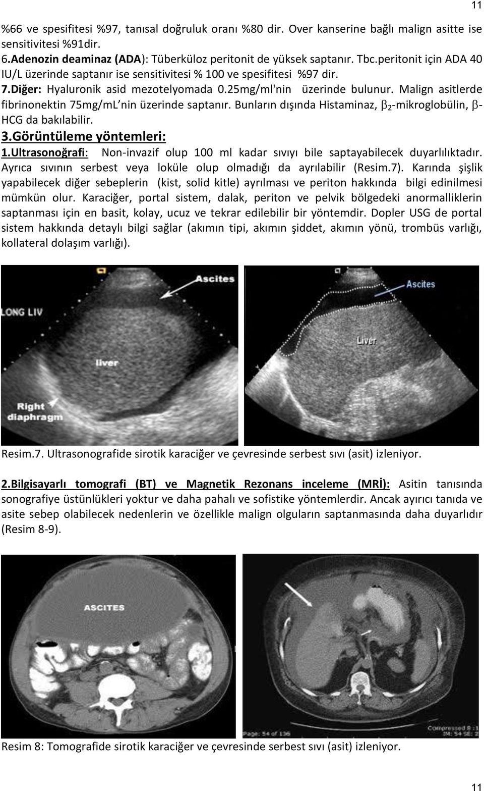 Malign asitlerde fibrinonektin 75mg/mL nin üzerinde saptanır. Bunların dışında Histaminaz, 2 -mikroglobülin, - HCG da bakılabilir. 3.Görüntüleme yöntemleri: 1.