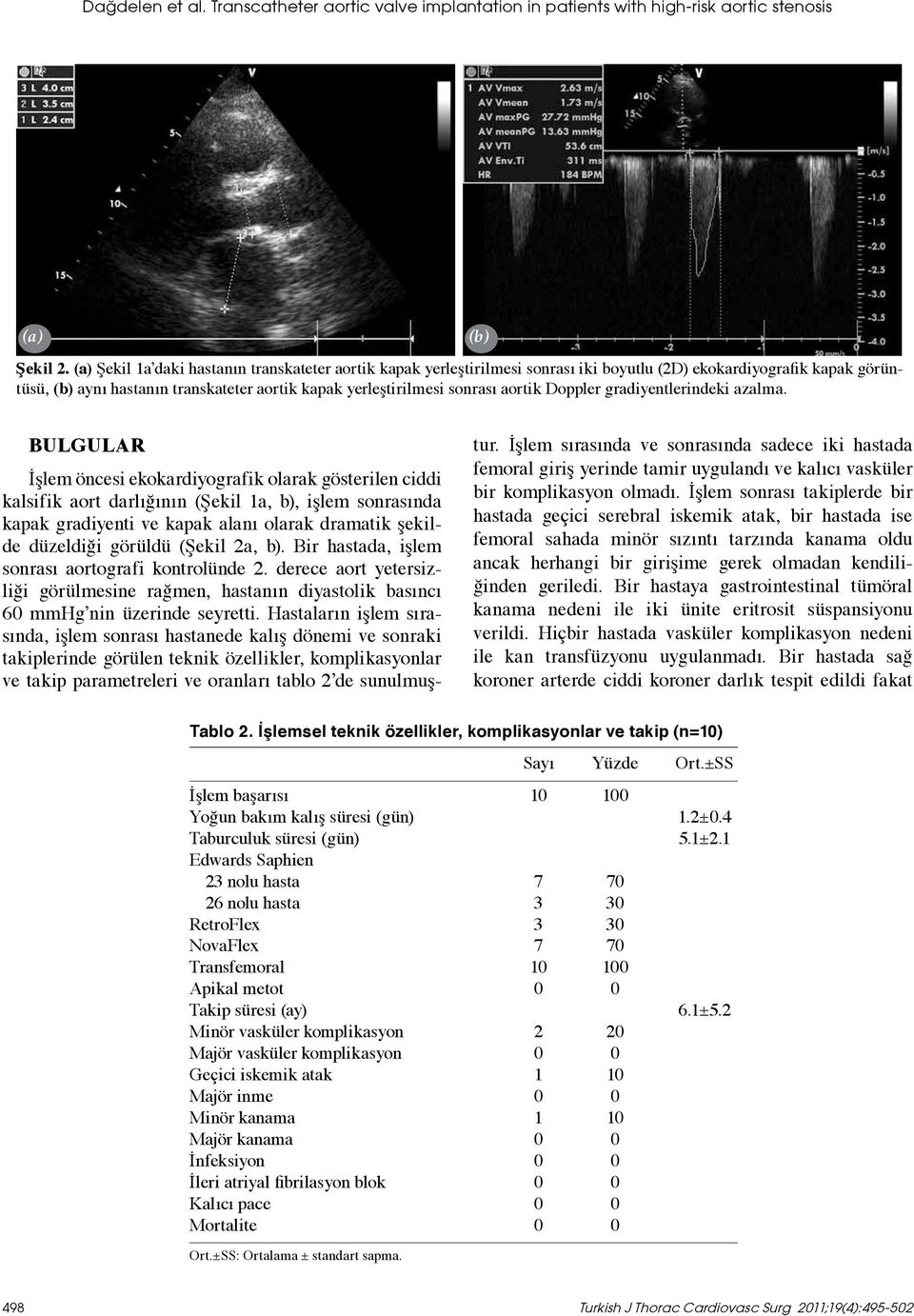 aortik Doppler gradiyentlerindeki azalma.