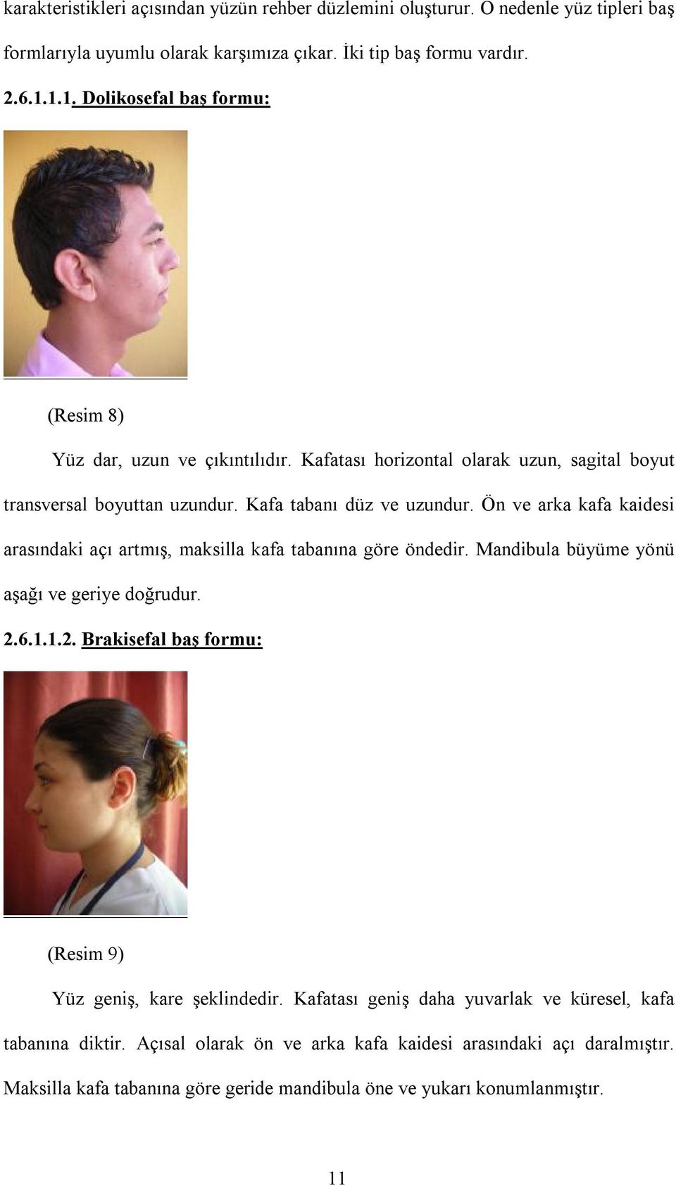 Ön ve arka kafa kaidesi arasındaki açı artmış, maksilla kafa tabanına göre öndedir. Mandibula büyüme yönü aşağı ve geriye doğrudur. 2.