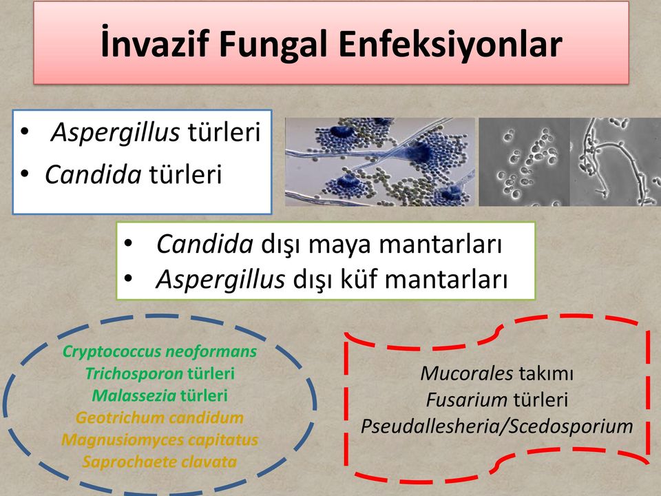 Trichosporon türleri Malassezia türleri Geotrichum candidum Magnusiomyces