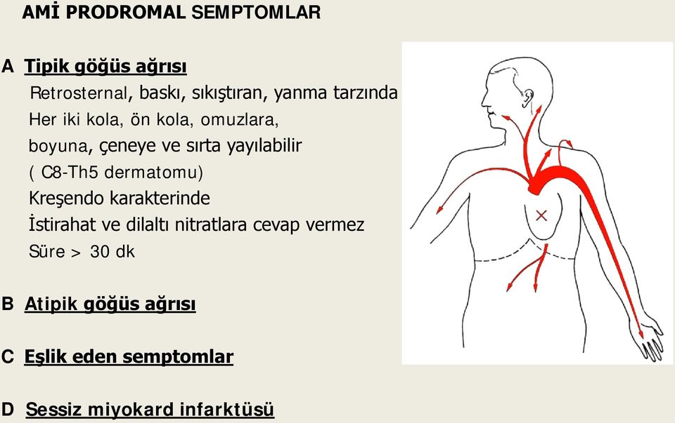 C8-Th5 dermatomu) Kreşendo karakterinde İstirahat ve dilaltı nitratlara cevap vermez