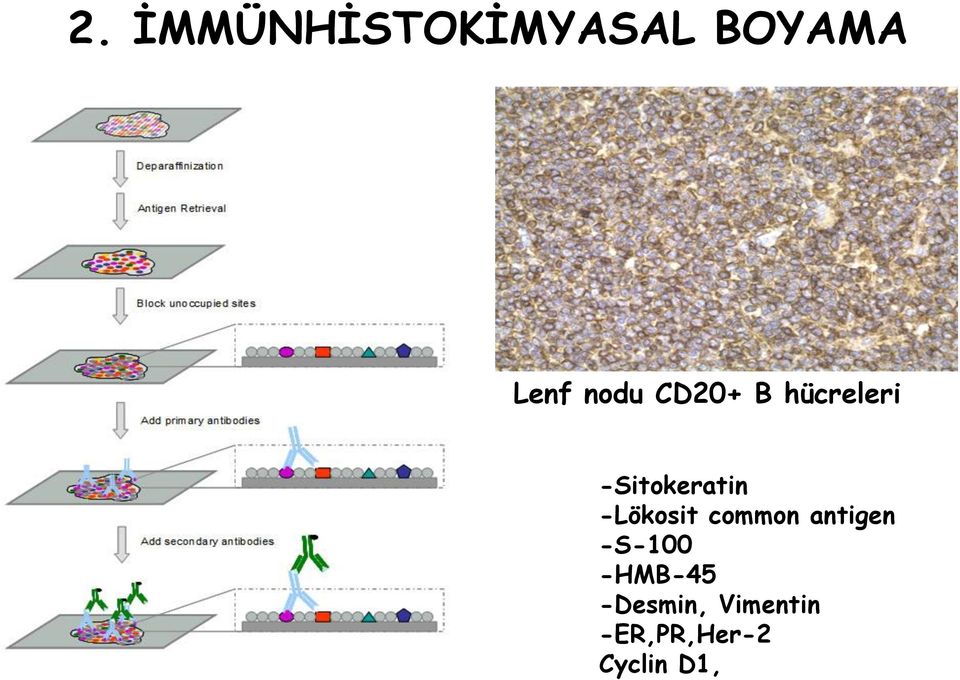 -Lökosit common antigen -S-100