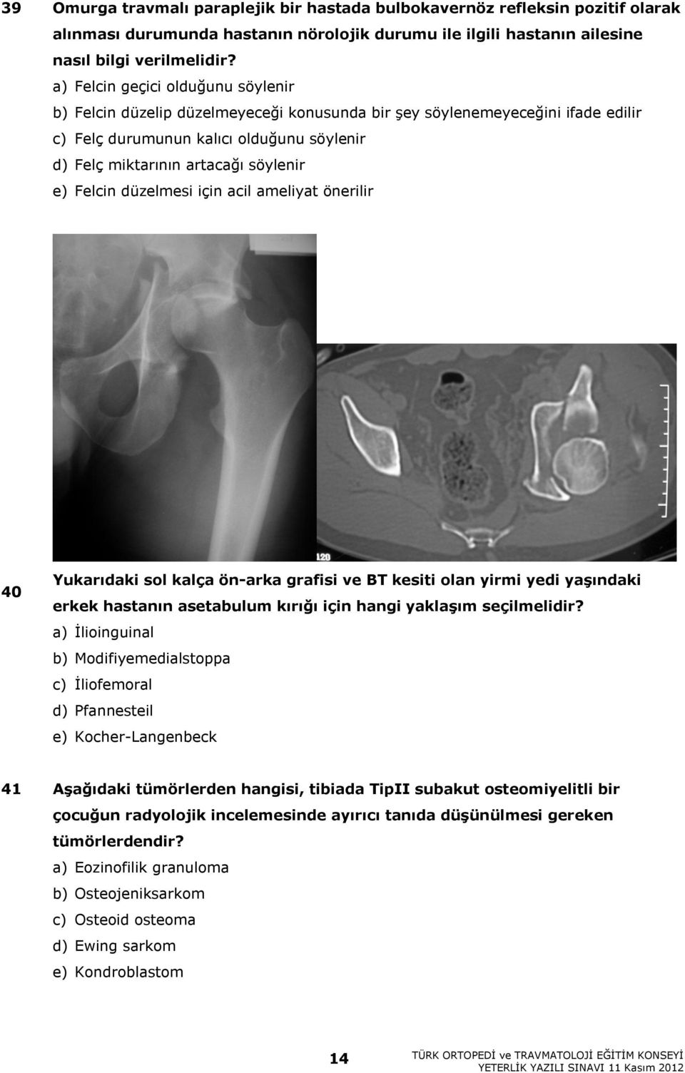 Felcin düzelmesi için acil ameliyat önerilir 40 Yukarıdaki sol kalça ön-arka grafisi ve BT kesiti olan yirmi yedi yaşındaki erkek hastanın asetabulum kırığı için hangi yaklaşım seçilmelidir?