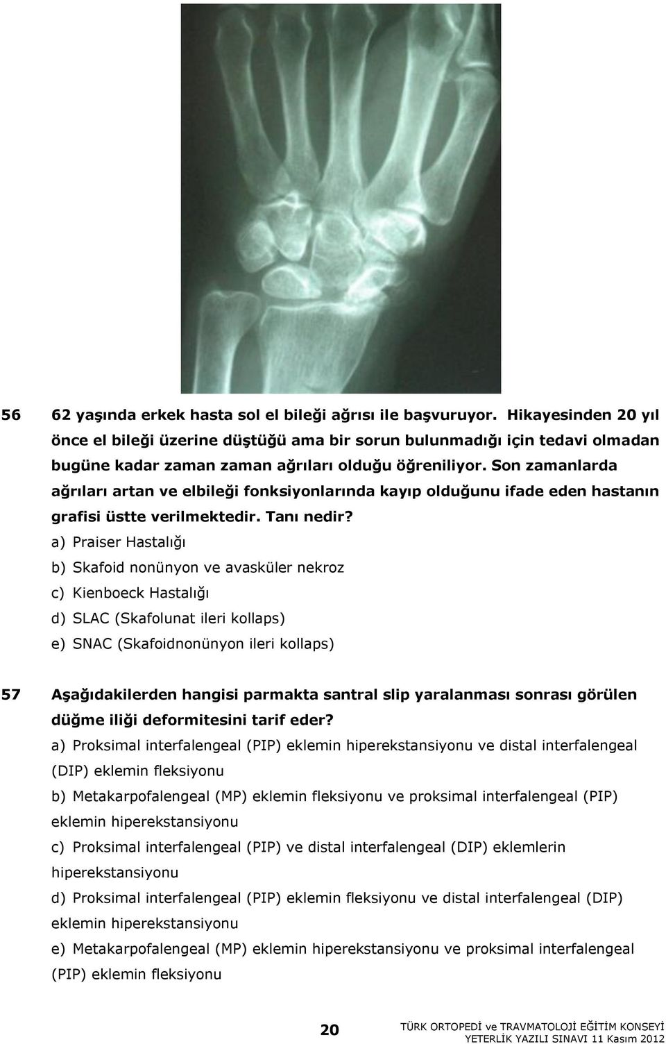 Son zamanlarda ağrıları artan ve elbileği fonksiyonlarında kayıp olduğunu ifade eden hastanın grafisi üstte verilmektedir. Tanı nedir?