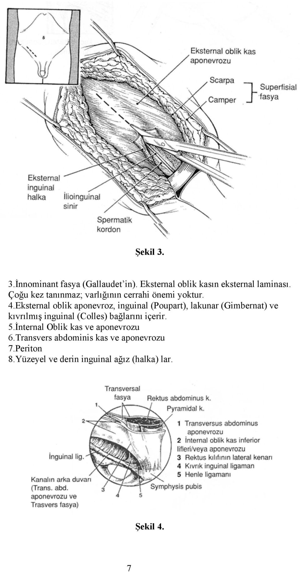 Eksternal oblik aponevroz, inguinal (Poupart), lakunar (Gimbernat) ve kıvrılmış inguinal (Colles)