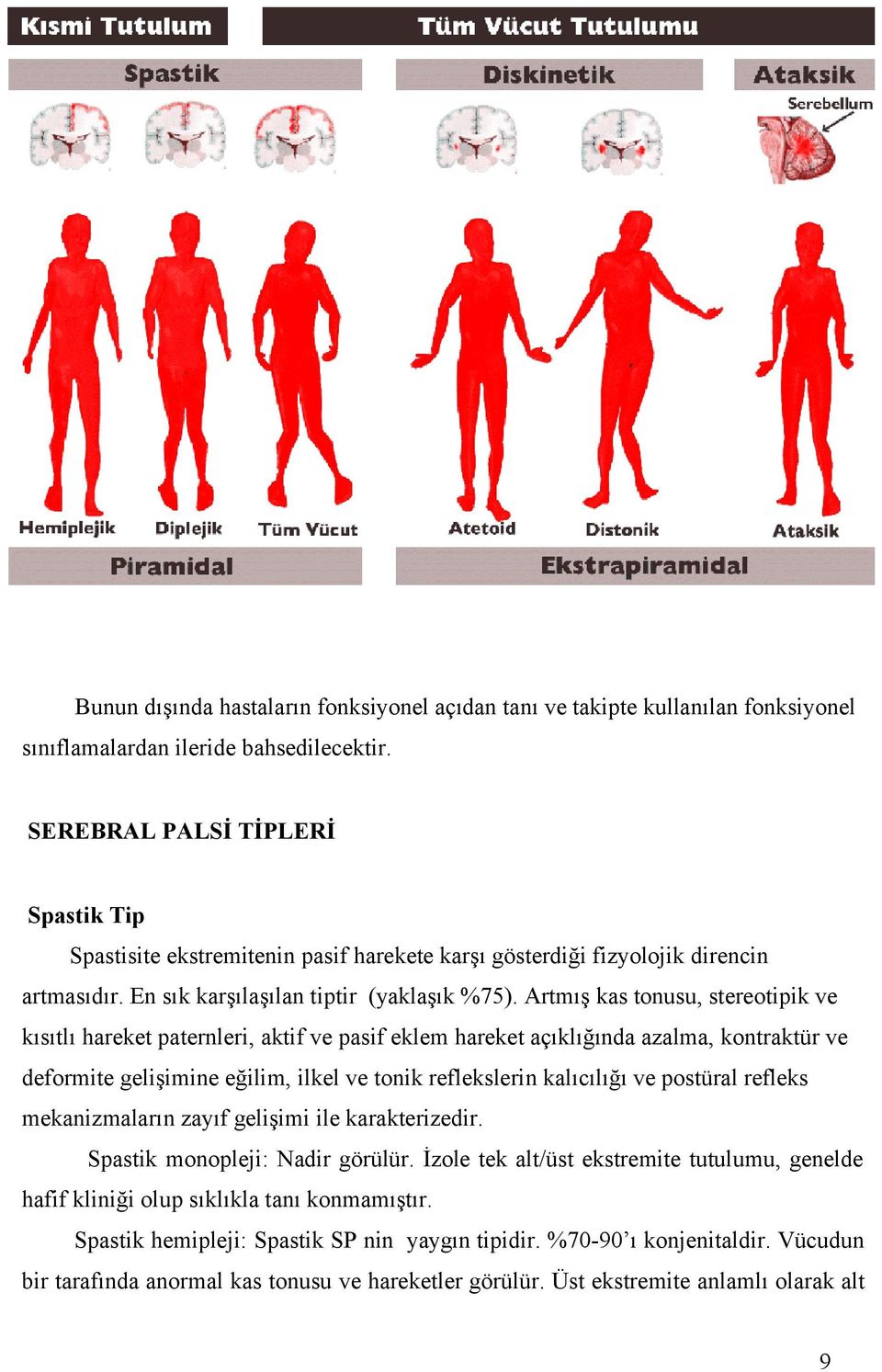 Artmış kas tonusu, stereotipik ve kısıtlı hareket paternleri, aktif ve pasif eklem hareket açıklığında azalma, kontraktür ve deformite gelişimine eğilim, ilkel ve tonik reflekslerin kalıcılığı ve