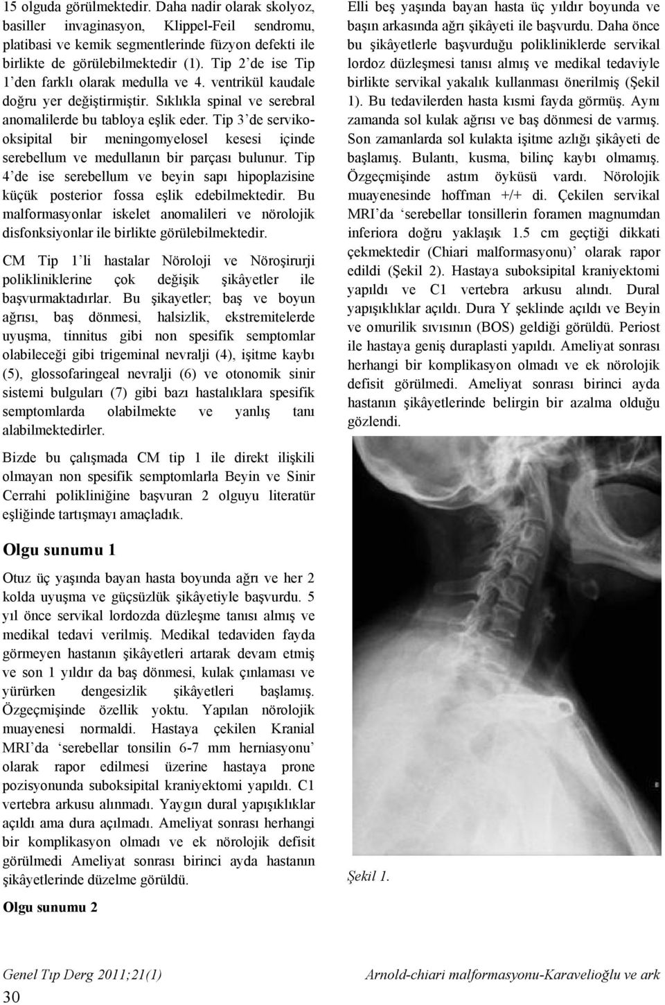 Tip 3 de servikooksipital bir meningomyelosel kesesi içinde serebellum ve medullanın bir parçası bulunur.