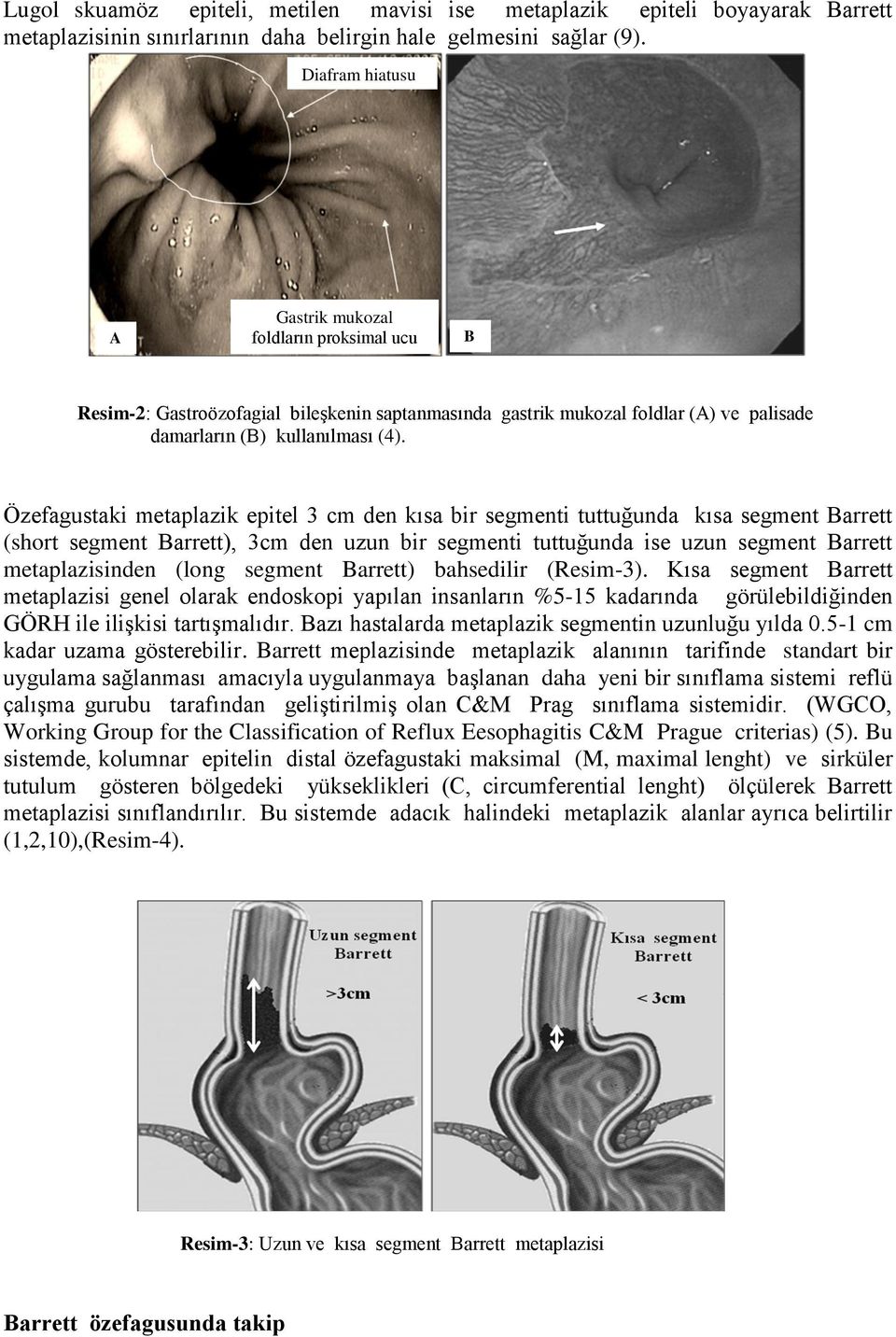 Özefagustaki metaplazik epitel 3 cm den kısa bir segmenti tuttuğunda kısa segment Barrett (short segment Barrett), 3cm den uzun bir segmenti tuttuğunda ise uzun segment Barrett metaplazisinden (long