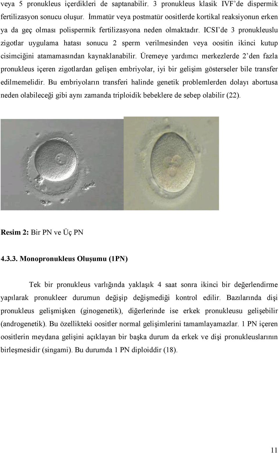 ICSI de 3 pronukleuslu zigotlar uygulama hatası sonucu 2 sperm verilmesinden veya oositin ikinci kutup cisimciğini atamamasından kaynaklanabilir.