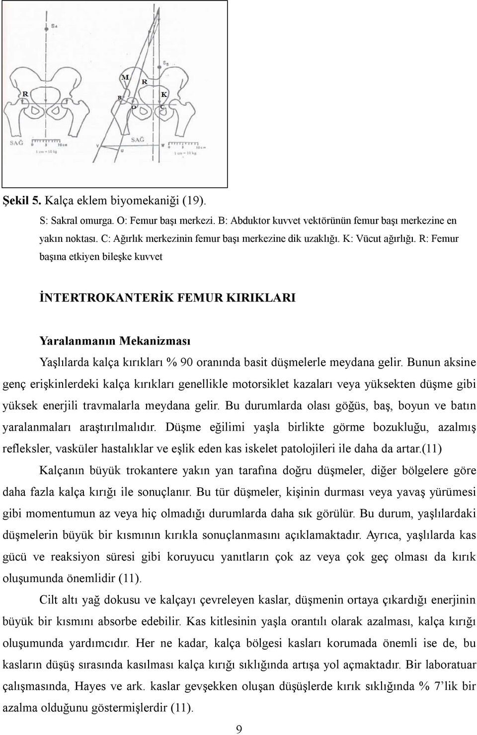 R: Femur başına etkiyen bileşke kuvvet İNTERTROKANTERİK FEMUR KIRIKLARI Yaralanmanın Mekanizması Yaşlılarda kalça kırıkları % 90 oranında basit düşmelerle meydana gelir.