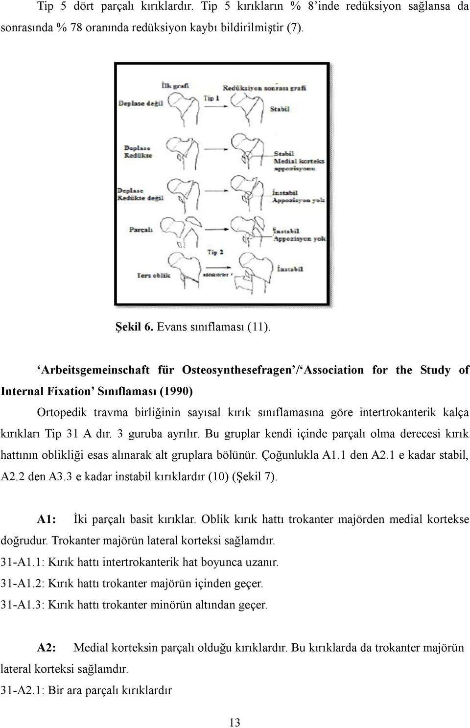 kırıkları Tip 31 A dır. 3 guruba ayrılır. Bu gruplar kendi içinde parçalı olma derecesi kırık hattının oblikliği esas alınarak alt gruplara bölünür. Çoğunlukla A1.1 den A2.1 e kadar stabil, A2.