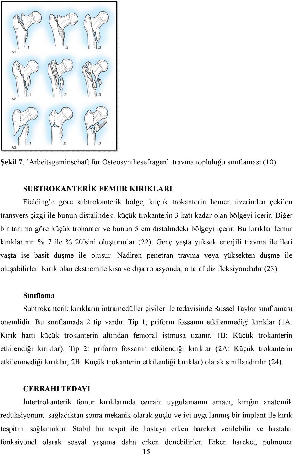 içerir. Diğer bir tanıma göre küçük trokanter ve bunun 5 cm distalindeki bölgeyi içerir. Bu kırıklar femur kırıklarının % 7 ile % 20 sini oluştururlar (22).