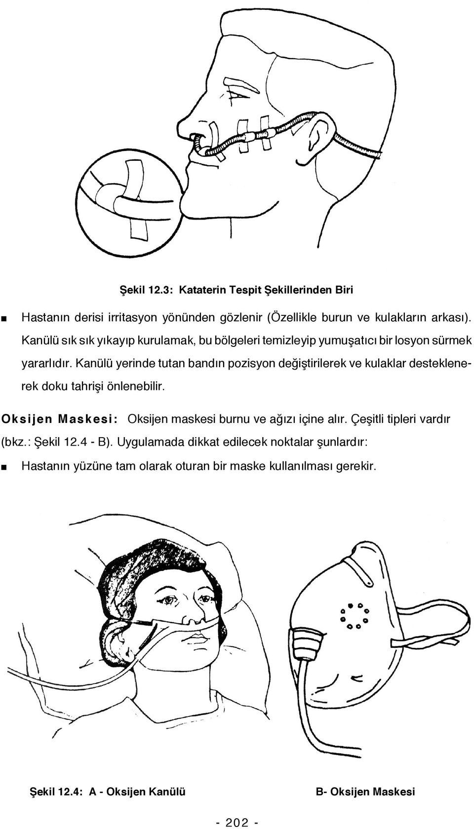 Kanülü yerinde tutan bandın pozisyon değiştirilerek ve kulaklar desteklenerek doku tahrişi önlenebilir.