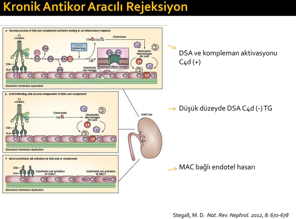 DSA C4d (-) TG MAC bağlı endotel hasarı