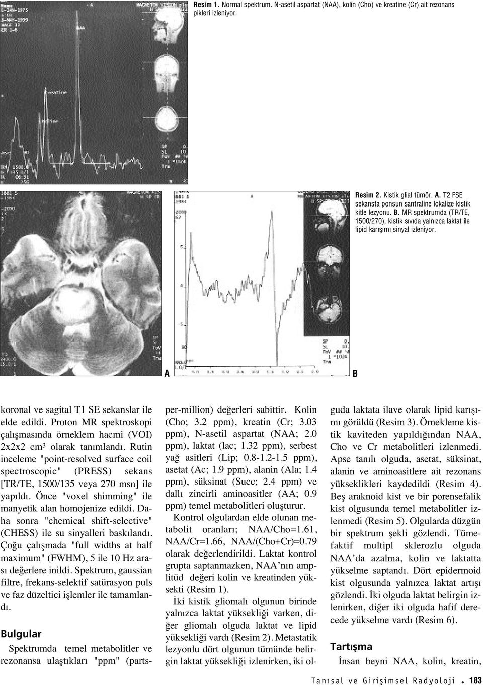 koronal ve sagital T1 SE sekanslar ile elde edildi. Proton MR spektroskopi çal şmas nda örneklem hacmi (VOI) 2x2x2 cm 3 olarak tan mland.