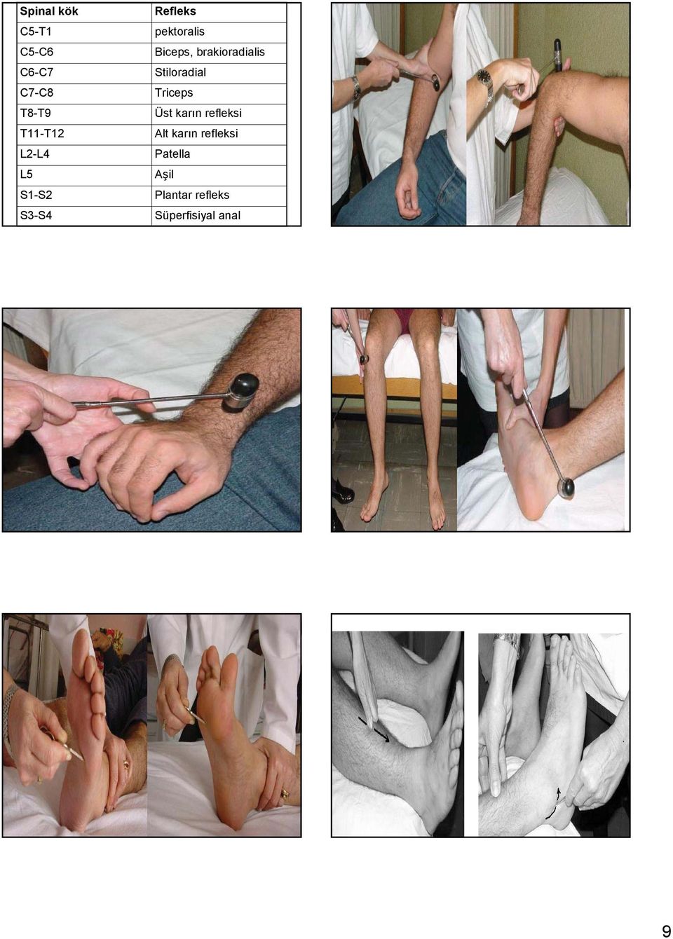 brakioradialis Stiloradial Triceps Üst karın refleksi