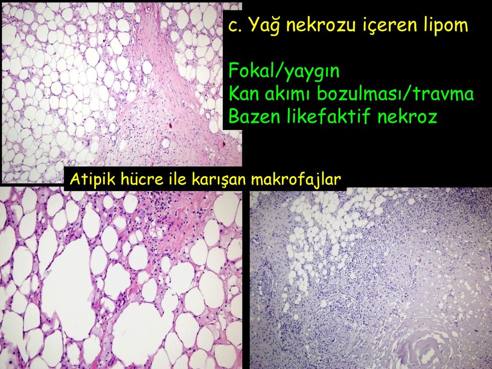 bozulması/travma Bazen