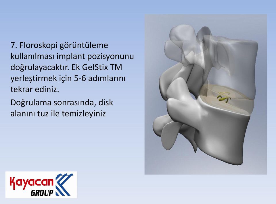 Ek GelStix TM yerleştirmek için 5-6 adımlarını