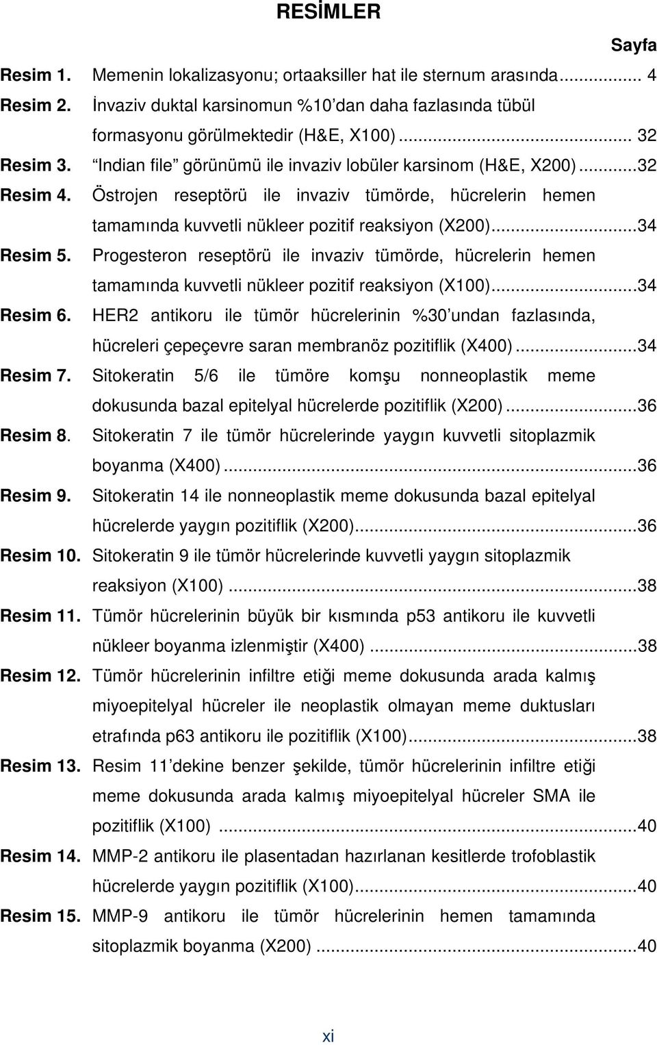 ..34 Resim 5. Progesteron reseptörü ile invaziv tümörde, hücrelerin hemen tamamında kuvvetli nükleer pozitif reaksiyon (X100)...34 Resim 6.