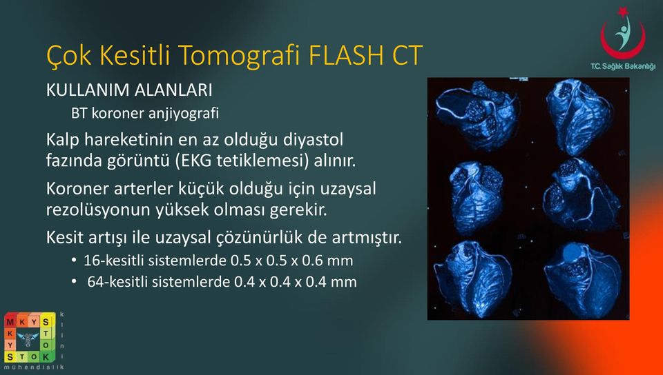 Koroner arterler küçük olduğu için uzaysal rezolüsyonun yüksek olması gerekir.