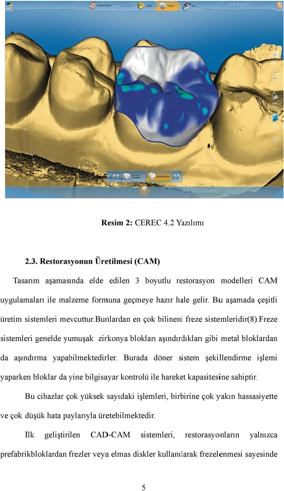 freze sistemlerii genelde yumuşak zirkonya blokları aşındırdıkları gibi metal bloklardan da aşındırma yapabilmektedirler.