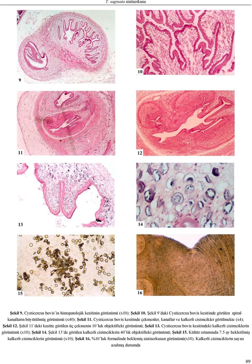 Cysticercus bovis kesitinde çekmenler, kanallar ve kalkerli cisimcikler görülmekte (x4); Şekil 12. Şekil 11 deki kesitte görülen üç çekmenin 10 luk objektifteki görünümü; Şekil 13.