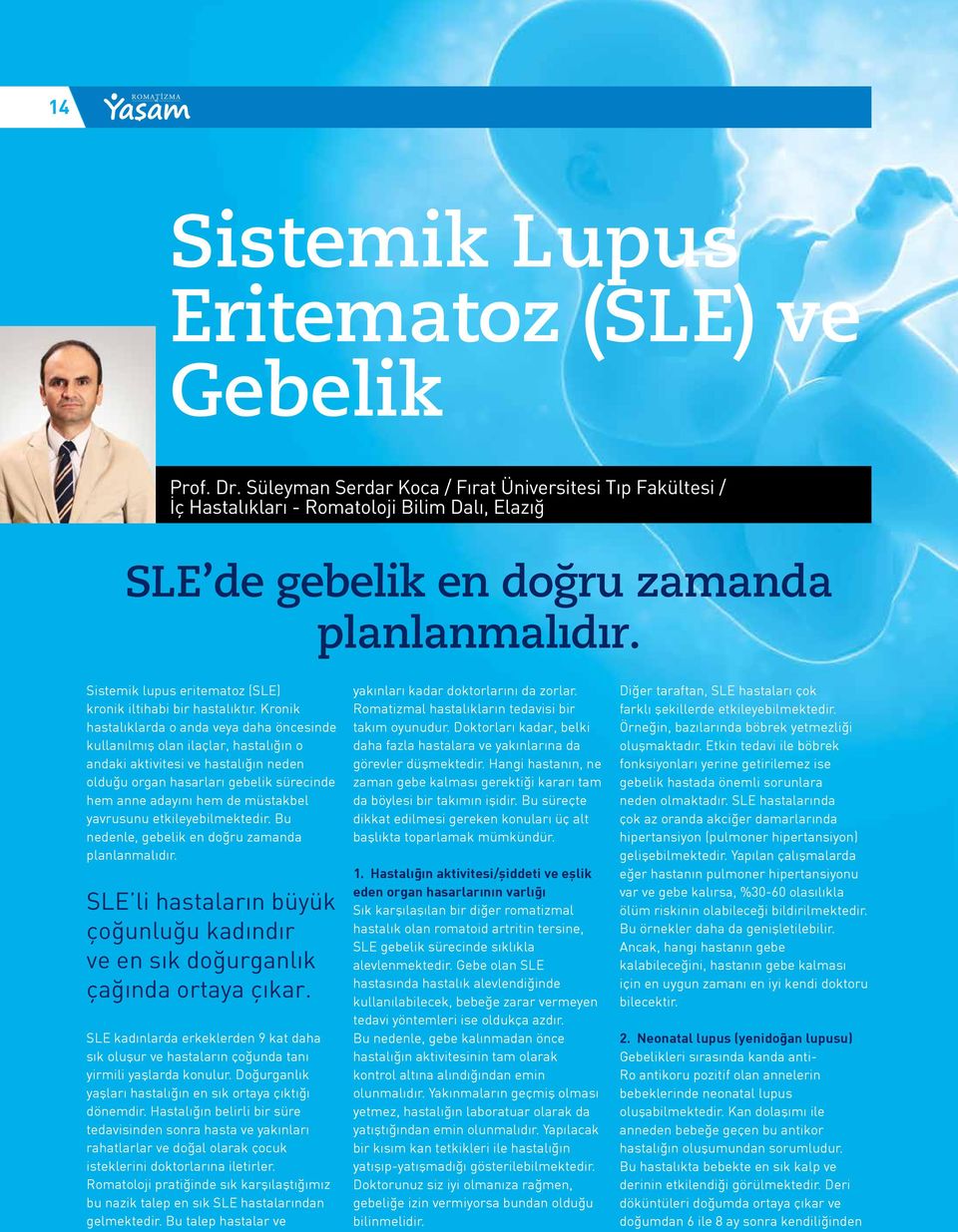 Sistemik lupus eritematoz (SLE) kronik iltihabi bir hastalıktır.