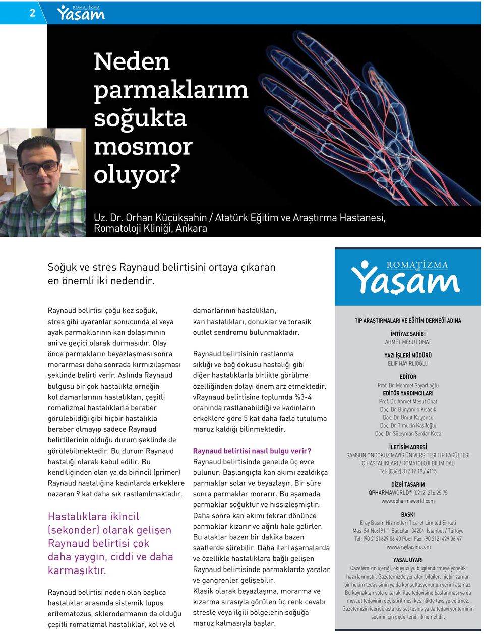 Raynaud belirtisi çoğu kez soğuk, stres gibi uyaranlar sonucunda el veya ayak parmaklarının kan dolaşımının ani ve geçici olarak durmasıdır.