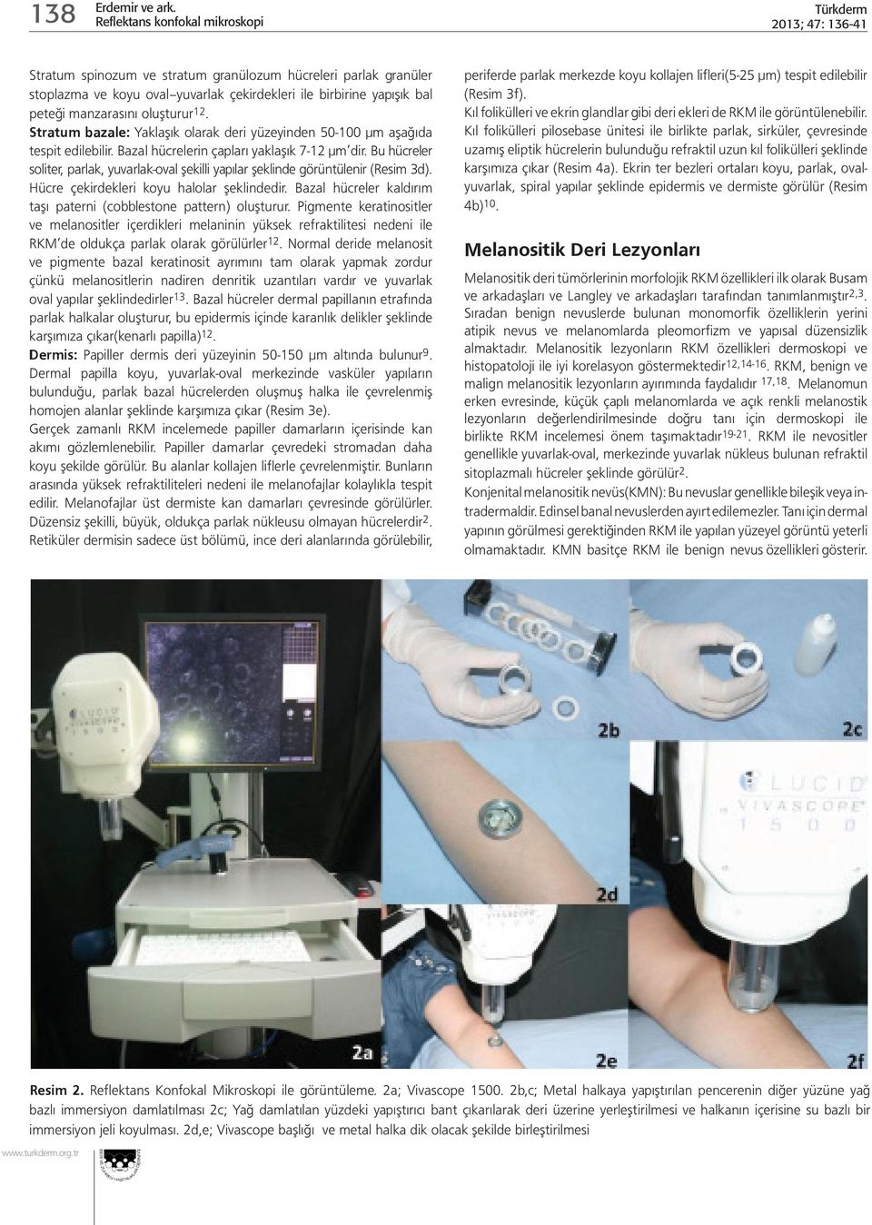 Bu hücreler soliter, parlak, yuvarlak-oval şekilli yapılar şeklinde görüntülenir (Resim 3d). Hücre çekirdekleri koyu halolar şeklindedir.