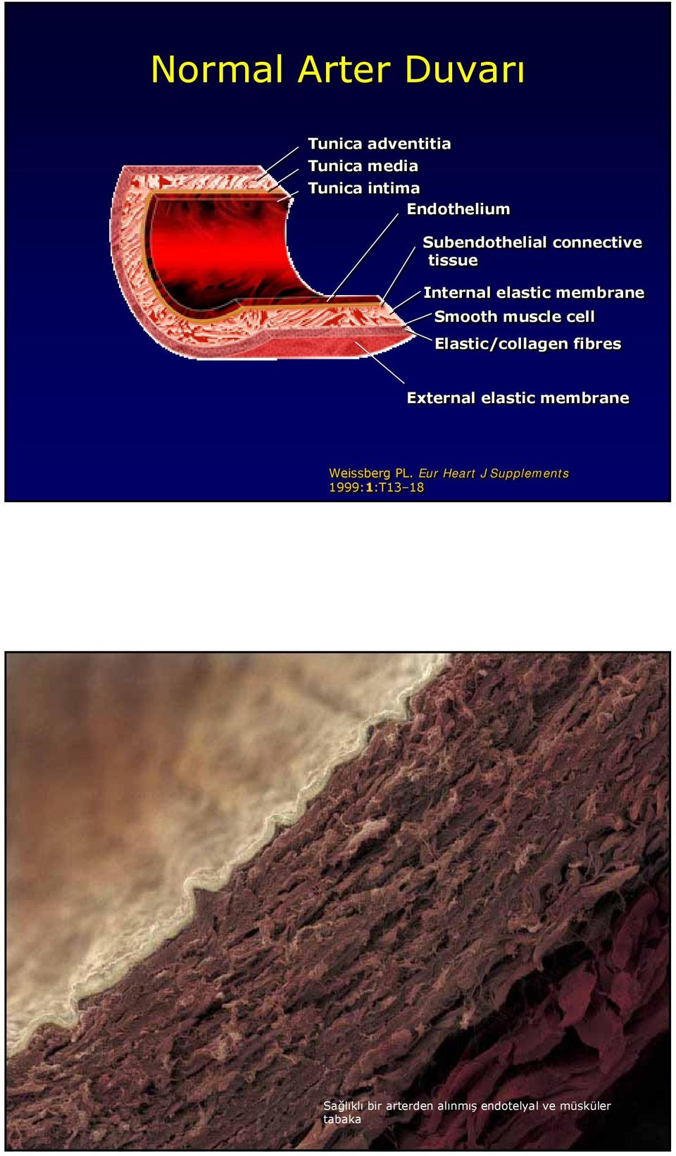 Elastic/collagen fibres External elastic membrane Weissberg PL.