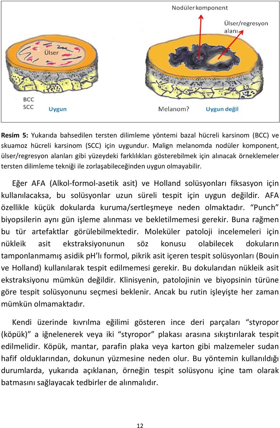 Eğer AFA (Alkol-formol-asetik asit) ve Holland solüsyonları fiksasyon için kullanılacaksa, bu solüsyonlar uzun süreli tespit için uygun değildir.