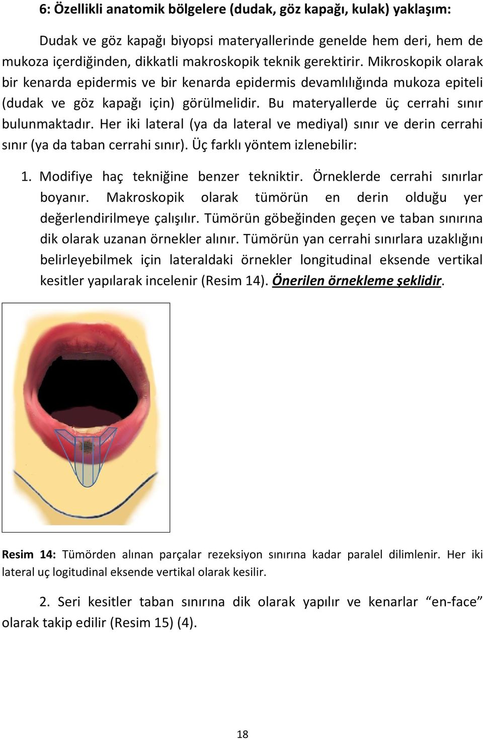 Her iki lateral (ya da lateral ve mediyal) sınır ve derin cerrahi sınır (ya da taban cerrahi sınır). Üç farklı yöntem izlenebilir: 1. Modifiye haç tekniğine benzer tekniktir.