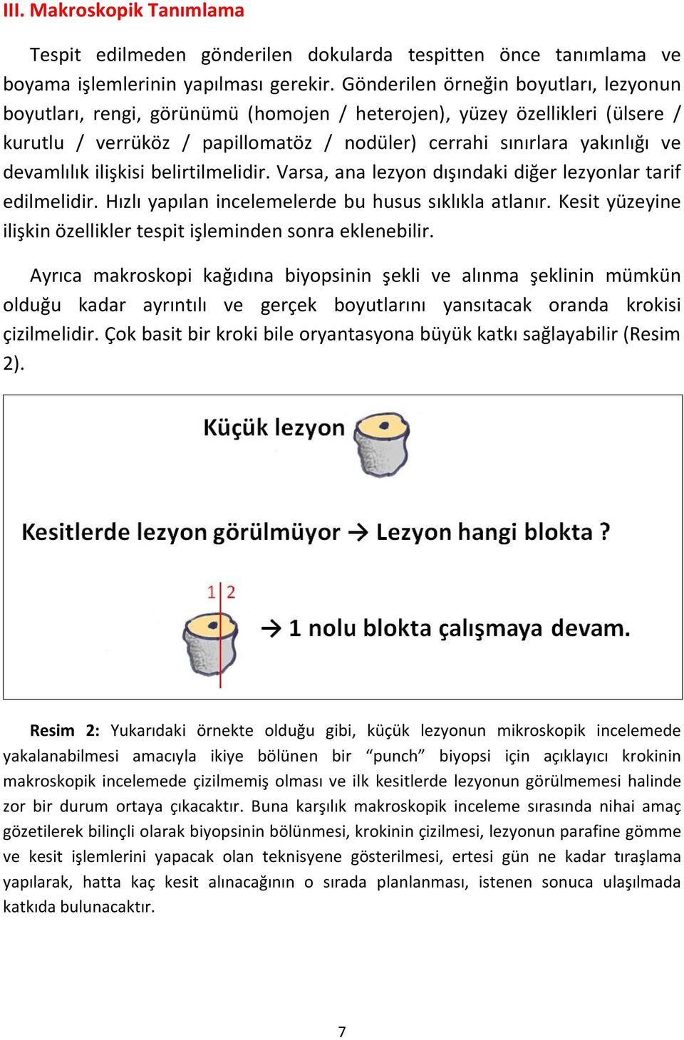 devamlılık ilişkisi belirtilmelidir. Varsa, ana lezyon dışındaki diğer lezyonlar tarif edilmelidir. Hızlı yapılan incelemelerde bu husus sıklıkla atlanır.