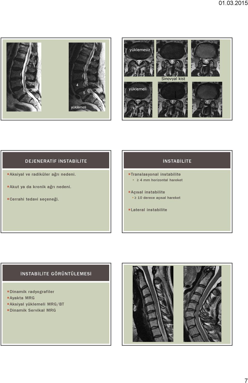 Translasyonal instabilite 4 mm horizontal hareket Açısal instabilite 10 derece açısal hareket