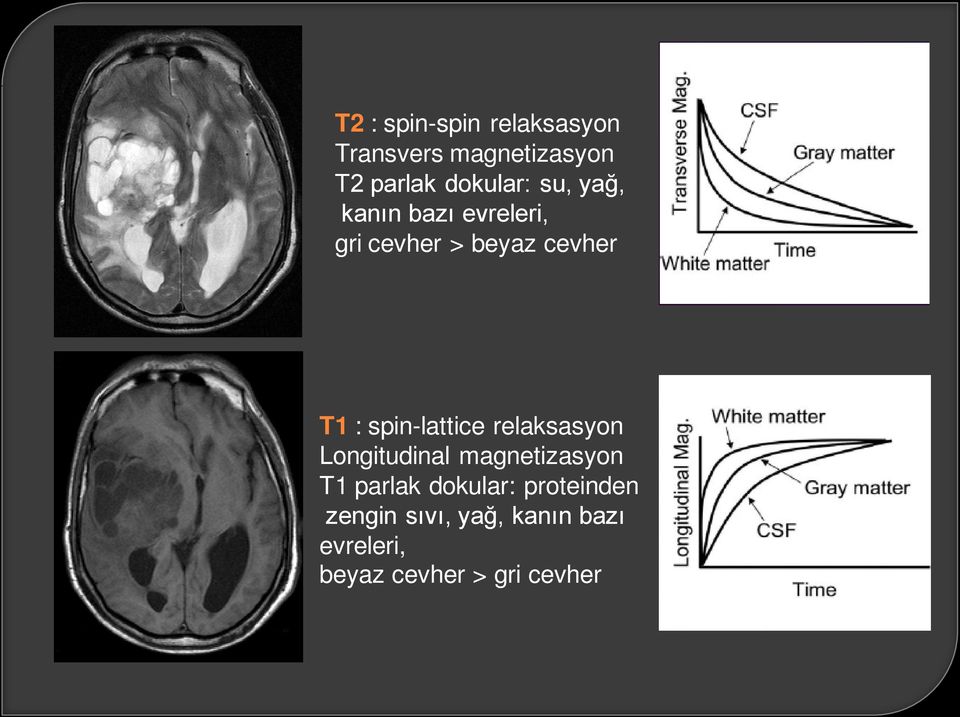 spin-lattice relaksasyon Longitudinal magnetizasyon T1 parlak