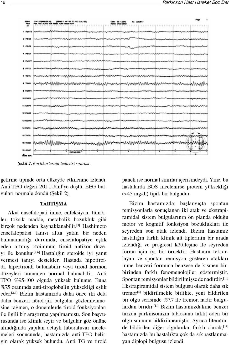 [3] Hashimoto ensefalopatisi tanısı altta yatan bir neden bulunamadığı durumda, ensefalopatiye eşlik eden artmış otoimmün tiroid antikor düzeyi ile konulur.