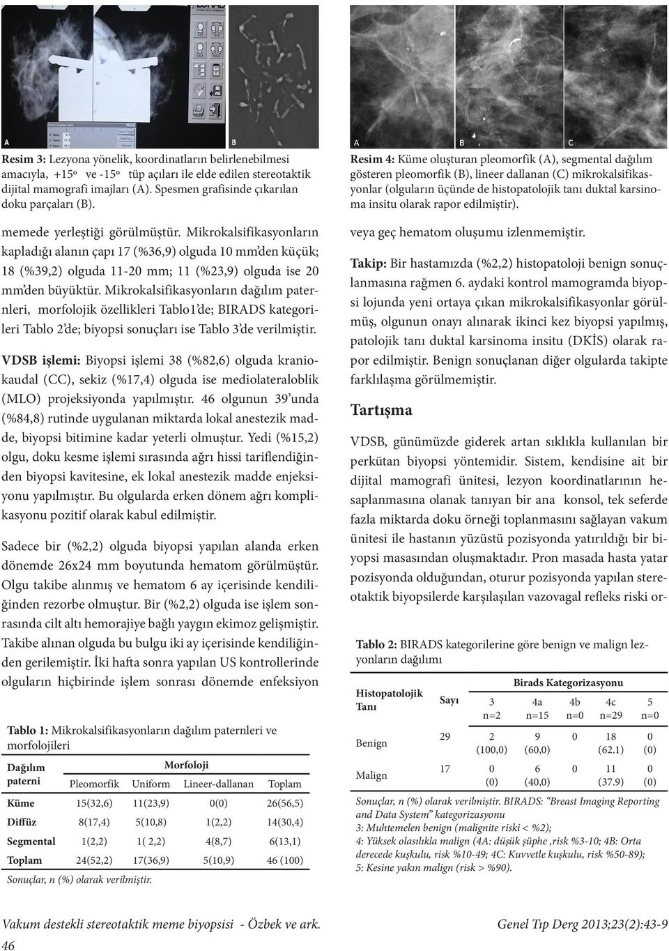 Mikrokalsifikasyonların kapladığı alanın çapı 17 (%36,9) olguda 10 mm den küçük; 18 (%39,2) olguda 11-20 mm; 11 (%23,9) olguda ise 20 mm den büyüktür.