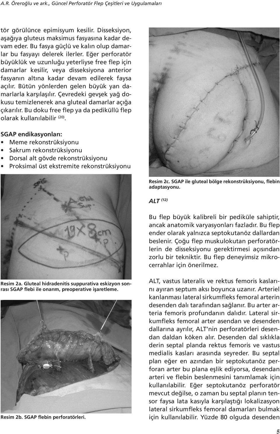 Eğer perforatör büyüklük ve uzunluğu yeterliyse free flep için damarlar kesilir, veya disseksiyona anterior fasyanın altına kadar devam edilerek faysa açılır.