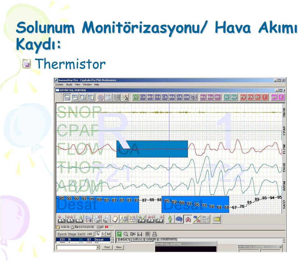 rizasyonu/ /