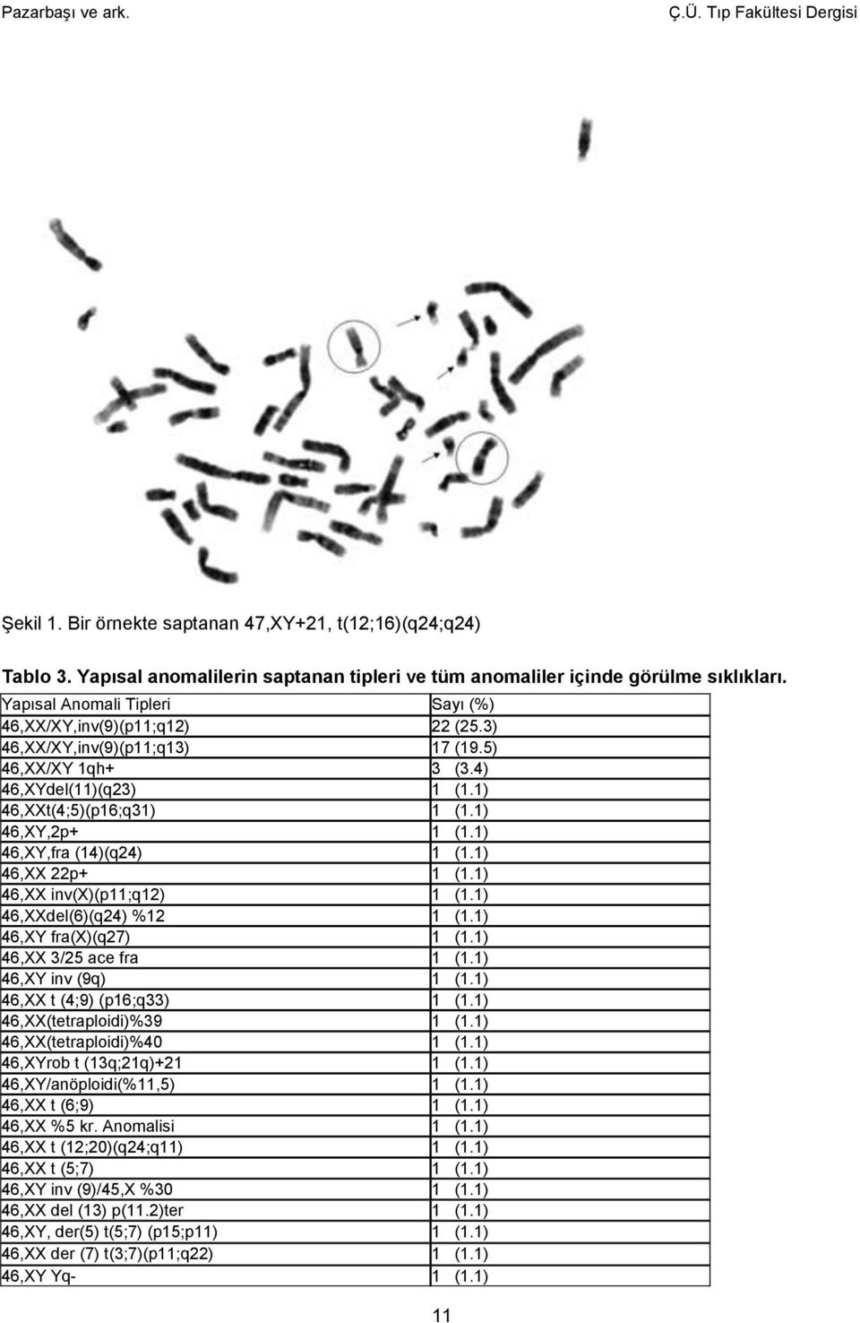 1) 46,XY,fra (14)(q24) 1 (1.1) 46,XX 22p+ 1 (1.1) 46,XX inv(x)(p11;q12) 1 (1.1) 46,XXdel(6)(q24) %12 1 (1.1) 46,XY fra(x)(q27) 1 (1.1) 46,XX 3/25 ace fra 1 (1.1) 46,XY inv (9q) 1 (1.