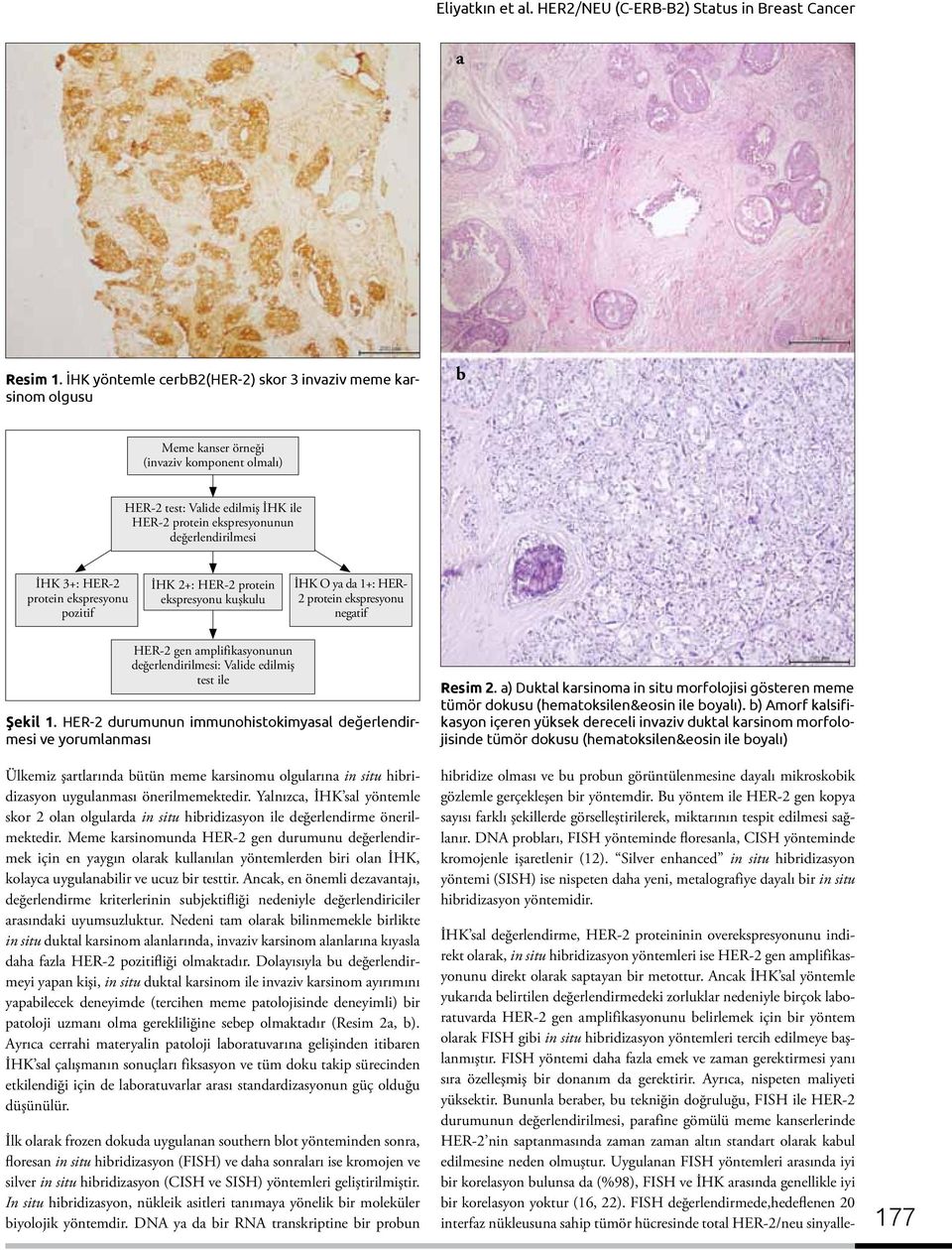 3+: HER-2 protein ekspresyonu pozitif İHK 2+: HER-2 protein ekspresyonu kuşkulu İHK O ya da 1+: HER- 2 protein ekspresyonu negatif HER-2 gen amplifikasyonunun değerlendirilmesi: Valide edilmiş test