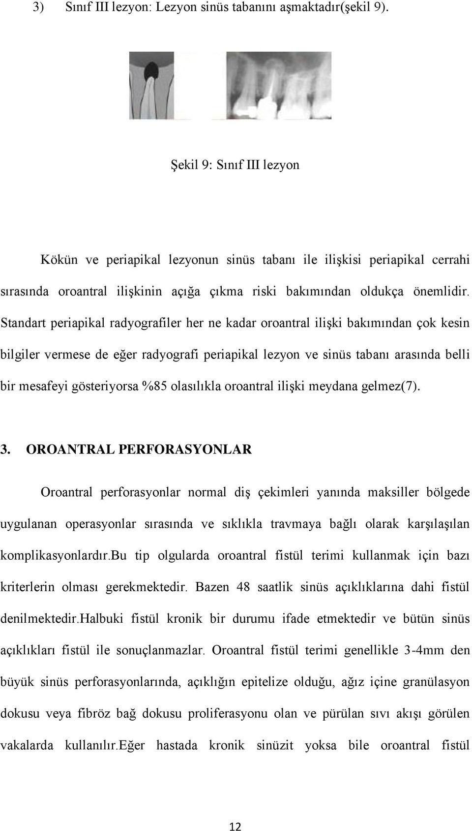 Standart periapikal radyografiler her ne kadar oroantral ilişki bakımından çok kesin bilgiler vermese de eğer radyografi periapikal lezyon ve sinüs tabanı arasında belli bir mesafeyi gösteriyorsa %85