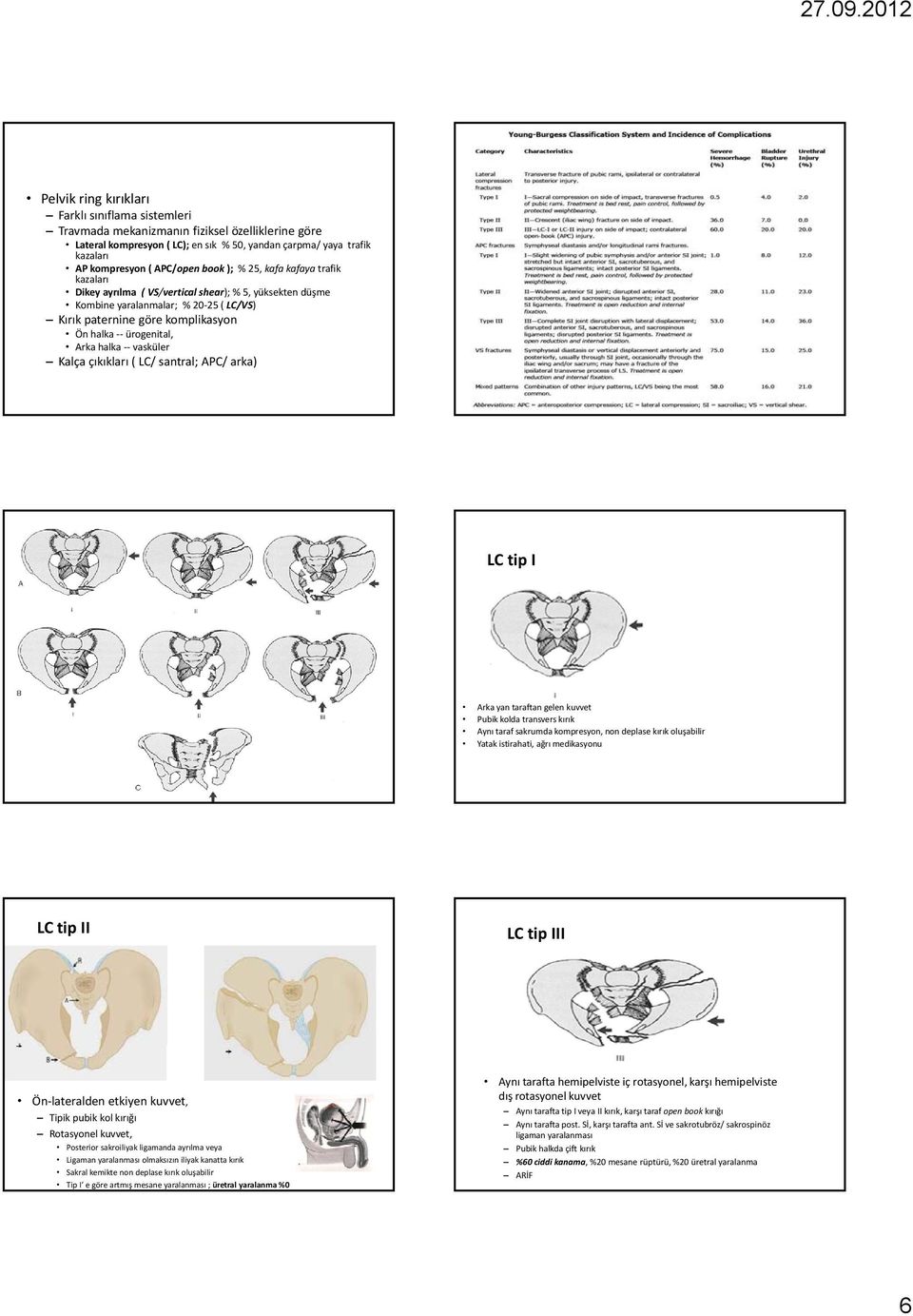 halka ürogenital, Arka halka vasküler Kalça çıkıkları ( LC/ santral; APC/ arka) LC tip I Arka yan taraftan gelen kuvvet Pubik kolda transvers kırık Aynı taraf sakrumda kompresyon, non deplase kırık