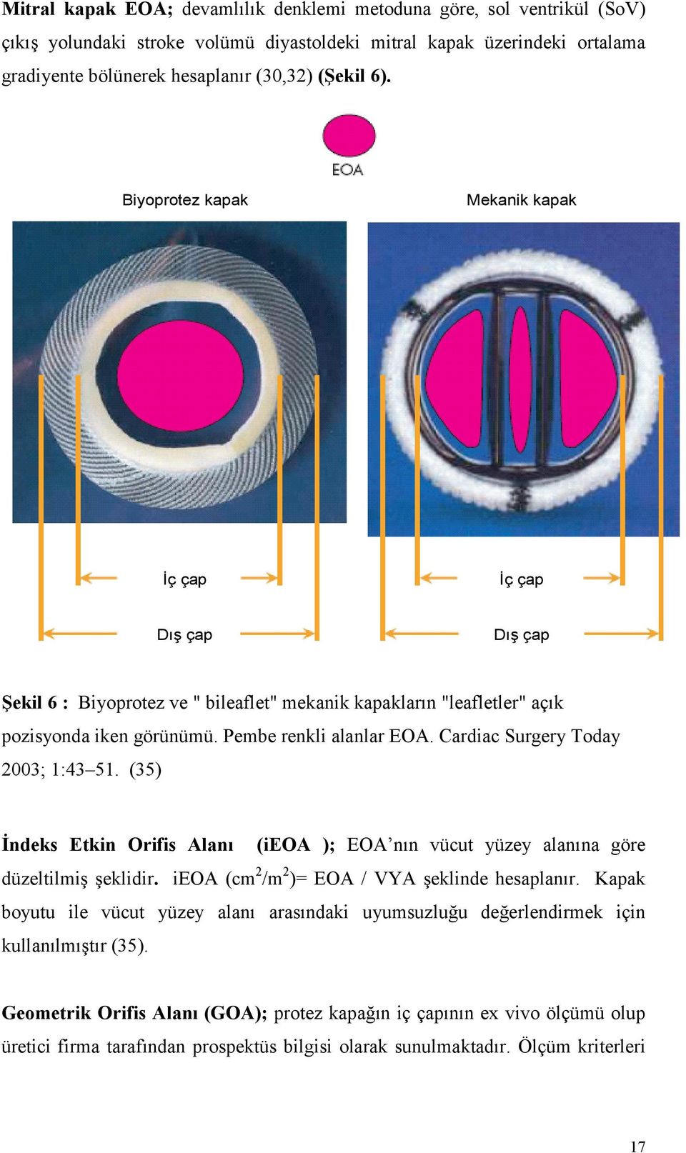 Cardiac Surgery Today 2003; 1:43 51. (35) İndeks Etkin Orifis Alanı (ieoa ); EOA nın vücut yüzey alanına göre düzeltilmiş şeklidir. ieoa (cm 2 /m 2 )= EOA / VYA şeklinde hesaplanır.