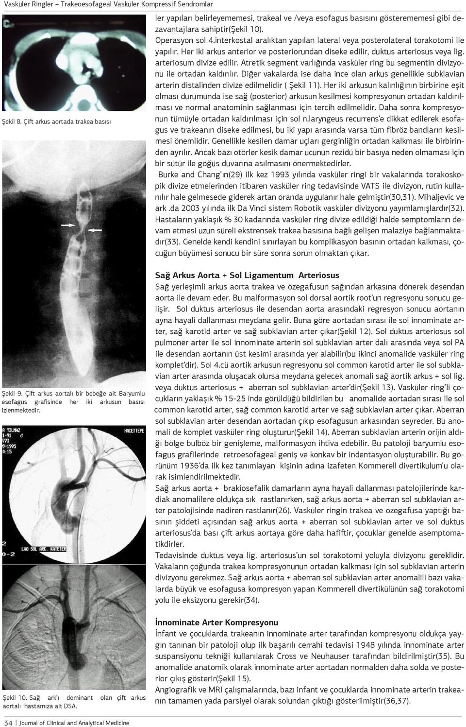 Atretik segment varlığında vasküler ring bu segmentin divizyonu ile ortadan kaldırılır.