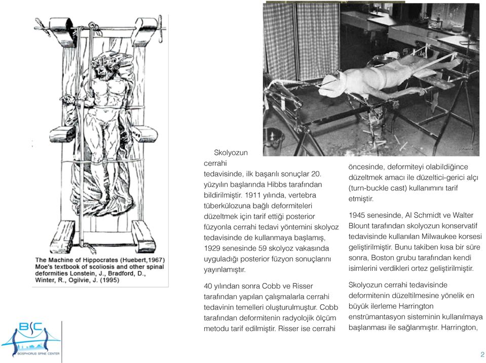 vakasında uyguladığı posterior füzyon sonuçlarını yayınlamıştır. 40 yılından sonra Cobb ve Risser tarafından yapılan çalışmalarla cerrahi tedavinin temelleri oluşturulmuştur.