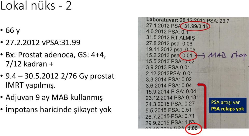 2012 2/76 Gy prostat IMRT yapılmış.