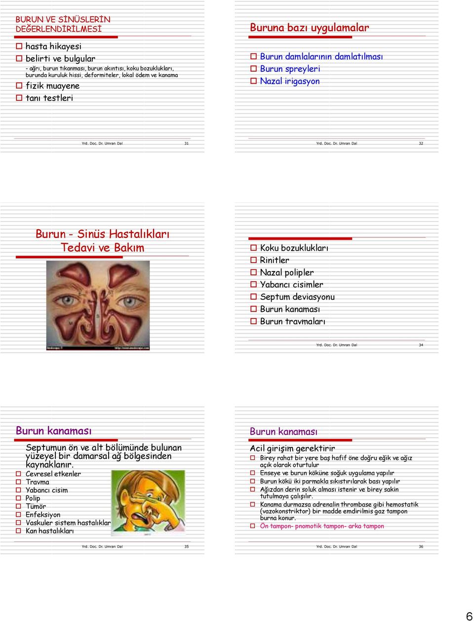 Umran Dal 31 Yrd. Doc. Dr. Umran Dal 32 Burun - Sinüs Hastalıkları Tedavi ve Bakım Koku bozuklukları Rinitler Nazal polipler Yabancı cisimler Septum deviasyonu Burun kanaması Burun travmaları Yrd.